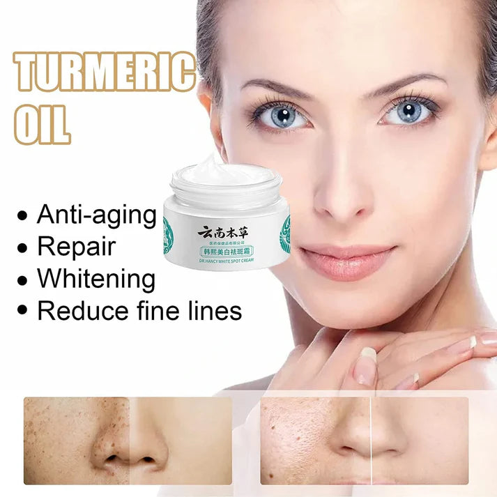 Japanese Melasma Cream | Buy1 Get1