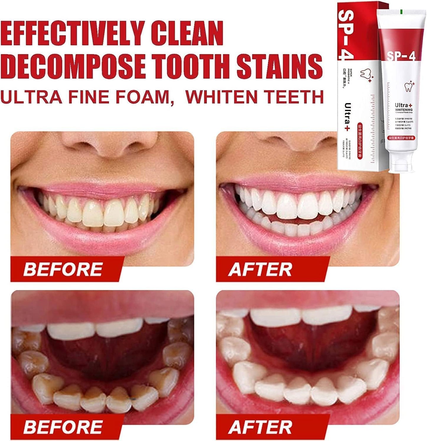 SP-4 Probiotics Whitening Toothpaste