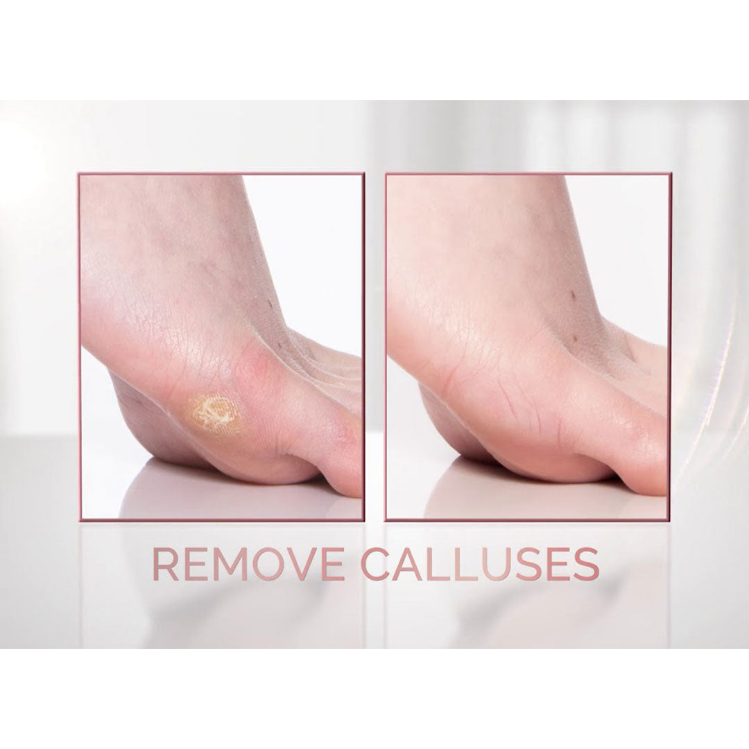 Electronic Pedi Tool File and Callus Remover, Pedicure