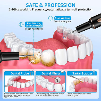 Ultrasonic Tartar Remover