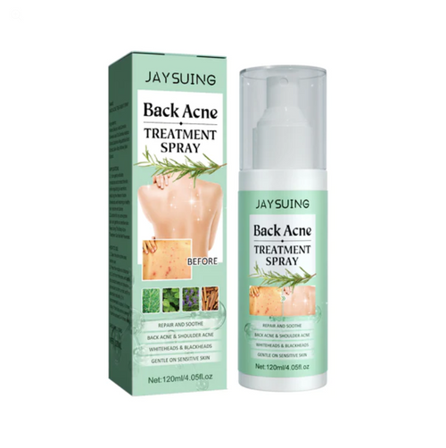 Back Acne Treatment Spray Removal Scar Pimple Acne Repair Serum Oil Control Shrink Pores Moisturizing Anti Acne Spray