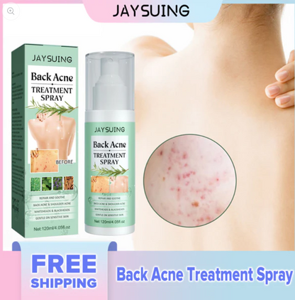 Back Acne Treatment Spray Removal Scar Pimple Acne Repair Serum Oil Control Shrink Pores Moisturizing Anti Acne Spray