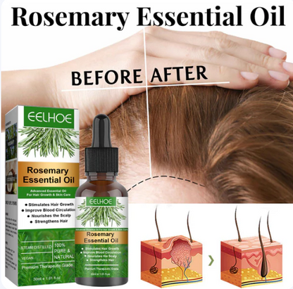 EELHOE Rosemary Essential Oil - Buy 1 Get 1 Free