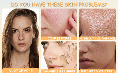 ORDINERY Solution for Blemishes, Acne, and Wrinkles, Toning Resurfacing Solution