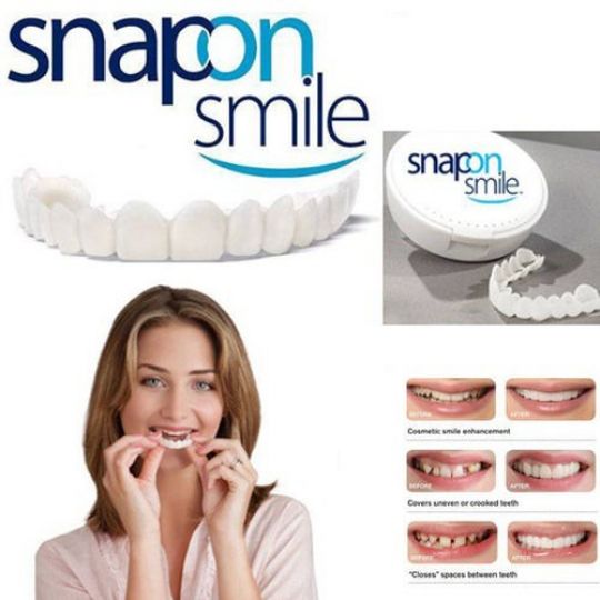 Snap On Smile - 2ps Up & Down