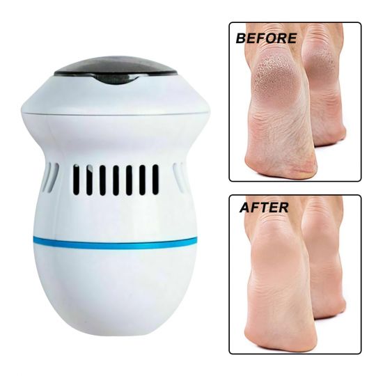 Wireless Dead Skin Callus Remover with 2000 RPM