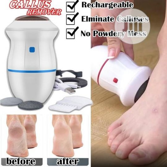 Wireless Dead Skin Callus Remover with 2000 RPM