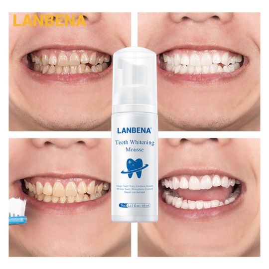 Lanbena Teeth Whitening Mousse Remove Teeth Stain and Freshen Breath