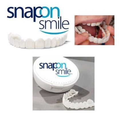 Snap On Smile - 2ps Up & Down