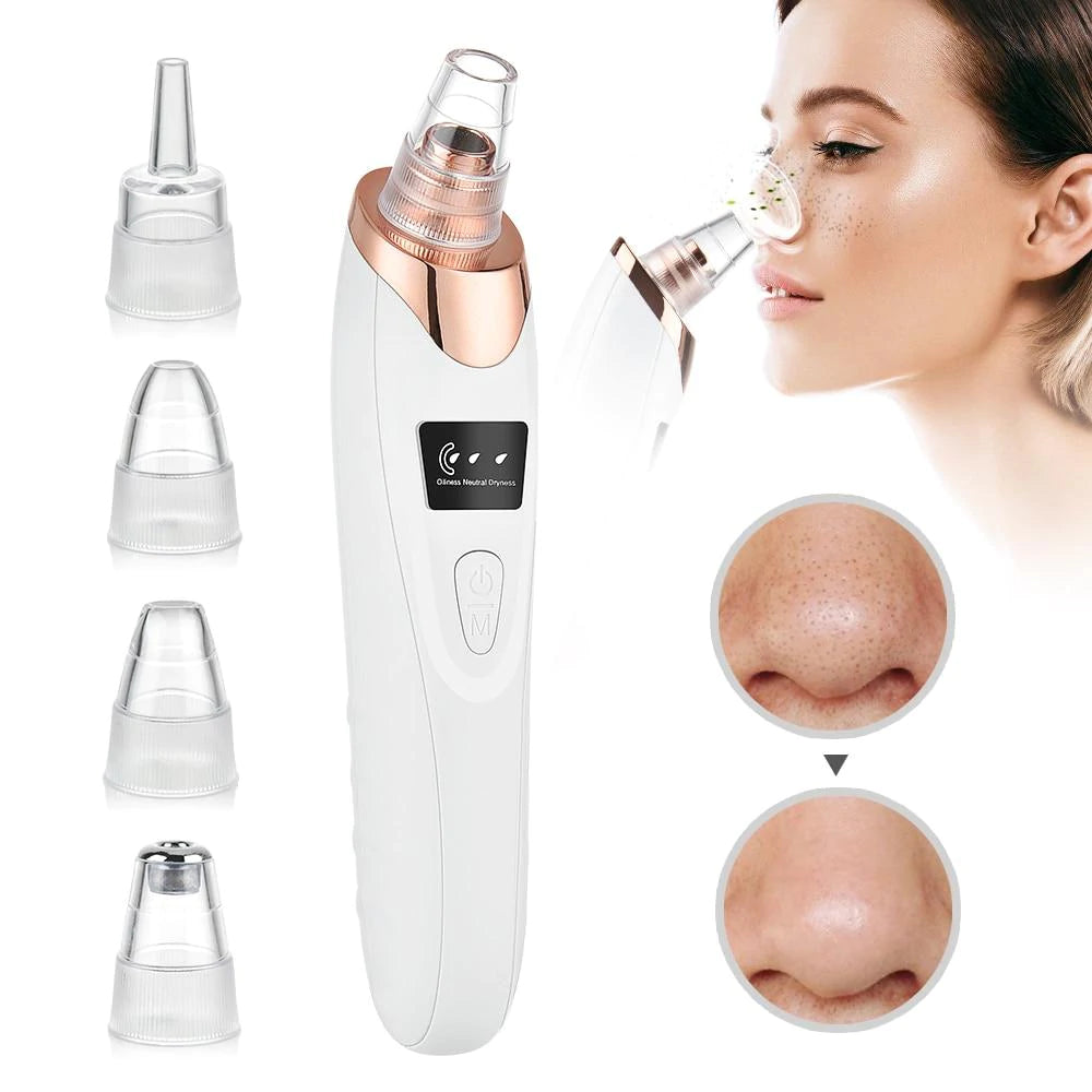 Blackhead Remover Vacuum Acne Pimple Black Spot Suction-Big Sale