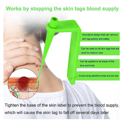 Auto Skin Tag Removal Kit